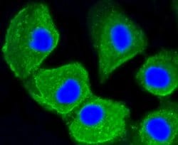 Invitrogen LC3A Recombinant Rabbit Monoclonal Antibody (ST47-03) 100 &mu;L;