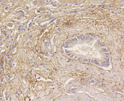 Invitrogen LC3A Recombinant Rabbit Monoclonal Antibody (ST47-03) 100 &mu;L;