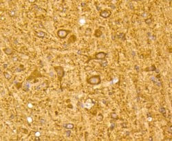 Invitrogen LC3A Recombinant Rabbit Monoclonal Antibody (ST47-03) 100 &mu;L;