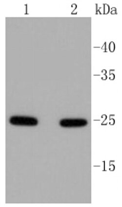 Invitrogen RAB5 Recombinant Rabbit Monoclonal Antibody (ST47-04) 100 &mu;L;