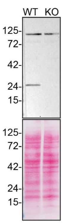 Invitrogen RAB5 Recombinant Rabbit Monoclonal Antibody (ST47-04) 100 &mu;L;