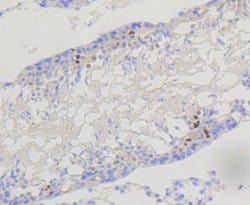 Invitrogen PIK3R2 Recombinant Rabbit Monoclonal Antibody (ST04-77) 100