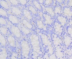 Invitrogen PIK3R2 Recombinant Rabbit Monoclonal Antibody (ST04-77) 100