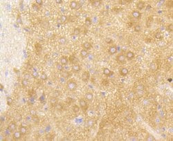 Invitrogen PIK3R2 Recombinant Rabbit Monoclonal Antibody (ST04-77) 100