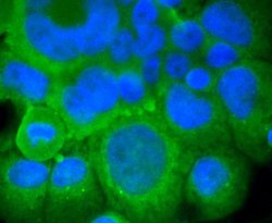 Invitrogen mGluR5 Recombinant Rabbit Monoclonal Antibody (ST51-00) 100 &mu;L | Buy Online | Invitrogen&trade; | Fisher Scientific