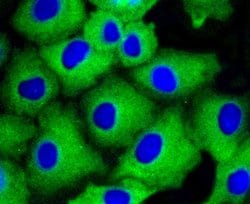Invitrogen beta Arrestin 1 Recombinant Rabbit Monoclonal Antibody (ST51-08) 100 &mu;L | Buy Online | Invitrogen&trade; | Fisher Scientific