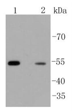 Invitrogen beta Arrestin 1 Recombinant Rabbit Monoclonal Antibody (ST51-08) 100 &mu;L | Buy Online | Invitrogen&trade; | Fisher Scientific