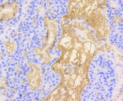 Invitrogen Vitronectin Recombinant Rabbit Monoclonal Antibody (ST49-02)