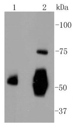 Invitrogen Vitronectin Recombinant Rabbit Monoclonal Antibody (ST49-02)