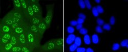 Invitrogen Phospho-JNK1/JNK2/JNK3 (Thr183, Thr221) Recombinant Rabbit Monoclonal