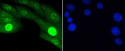 Invitrogen Phospho-JNK1/JNK2/JNK3 (Thr183, Thr221) Recombinant Rabbit Monoclonal