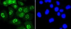 Invitrogen Phospho-JNK1/JNK2/JNK3 (Thr183, Thr221) Recombinant Rabbit Monoclonal