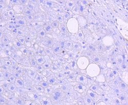 Invitrogen Phospho-JNK1/JNK2/JNK3 (Thr183, Thr221) Recombinant Rabbit Monoclonal