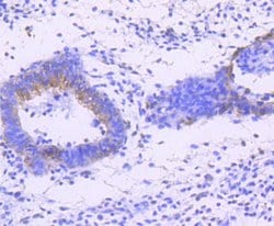 Invitrogen Phospho-JNK1/JNK2/JNK3 (Thr183, Thr221) Recombinant Rabbit Monoclonal