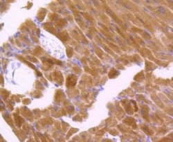 Invitrogen Phospho-JNK1/JNK2/JNK3 (Thr183, Thr221) Recombinant Rabbit Monoclonal