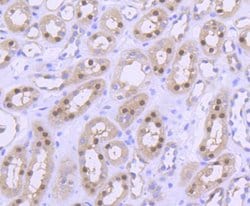 Invitrogen PRMT5 Recombinant Rabbit Monoclonal Antibody (ST51-06) 100 &mu;L | Buy Online | Invitrogen&trade; | Fisher Scientific