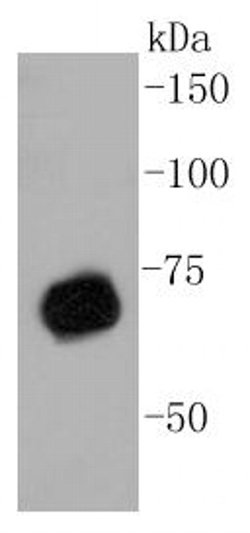 Invitrogen PRMT5 Recombinant Rabbit Monoclonal Antibody (ST51-06) 100 &mu;L | Buy Online | Invitrogen&trade; | Fisher Scientific