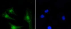 Invitrogen PKC beta-2 Recombinant Rabbit Monoclonal Antibody (ST48-06)