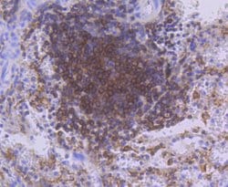 Invitrogen PKC beta-2 Recombinant Rabbit Monoclonal Antibody (ST48-06)