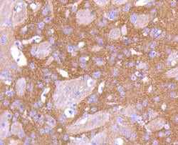Invitrogen PKC beta-2 Recombinant Rabbit Monoclonal Antibody (ST48-06)