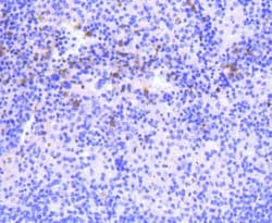 Invitrogen PKC beta-2 Recombinant Rabbit Monoclonal Antibody (ST48-06)