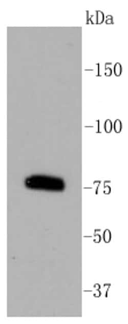 Invitrogen PKC beta-2 Recombinant Rabbit Monoclonal Antibody (ST48-06)