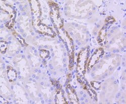 Invitrogen beta Tubulin 2,4 Recombinant Rabbit Monoclonal Antibody (ST52-04) 100 &mu;L | Buy Online | Invitrogen&trade; | Fisher Scientific