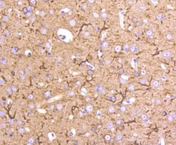 Invitrogen beta Tubulin 2,4 Recombinant Rabbit Monoclonal Antibody (ST52-04) 100 &mu;L | Buy Online | Invitrogen&trade; | Fisher Scientific