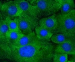 Invitrogen Phospho-MEK1 (Ser218, Ser222) Recombinant Rabbit Monoclonal
