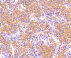 Invitrogen Phospho-MEK1 (Ser218, Ser222) Recombinant Rabbit Monoclonal