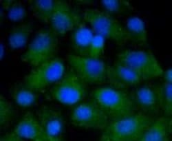 Invitrogen CD4 Recombinant Rabbit Monoclonal Antibody (ST0488) 100 &mu;L | Buy Online | Invitrogen&trade; | Fisher Scientific