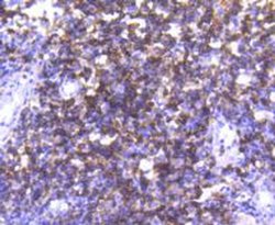 Invitrogen CD4 Recombinant Rabbit Monoclonal Antibody (ST0488) 100 &mu;L | Buy Online | Invitrogen&trade; | Fisher Scientific