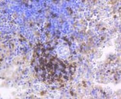 Invitrogen CD4 Recombinant Rabbit Monoclonal Antibody (ST0488) 100 &mu;L | Buy Online | Invitrogen&trade; | Fisher Scientific