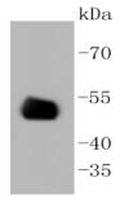 Invitrogen CD4 Recombinant Rabbit Monoclonal Antibody (ST0488) 100 &mu;L | Buy Online | Invitrogen&trade; | Fisher Scientific