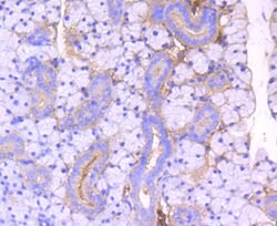 Invitrogen ROCK1 Recombinant Rabbit Monoclonal Antibody (ST05-19) 100 &mu;L;