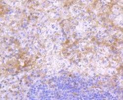Invitrogen Human IgG4 Recombinant Rabbit Monoclonal Antibody (ST05-12)