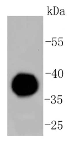 Invitrogen Human IgG4 Recombinant Rabbit Monoclonal Antibody (ST05-12)