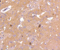 Invitrogen nNOS Recombinant Rabbit Monoclonal Antibody (ST520) 100 &mu;L;