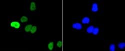 Invitrogen Phospho-c-Myc (Ser62) Recombinant Rabbit Monoclonal Antibody
