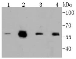 Invitrogen Phospho-c-Myc (Ser62) Recombinant Rabbit Monoclonal Antibody