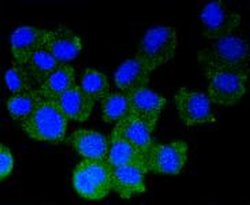 Invitrogen Synuclein alpha/beta Recombinant Rabbit Monoclonal Antibody (ST05-21) 100 &mu;L | Buy Online | Invitrogen&trade; | Fisher Scientific