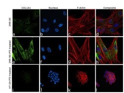 Collagen I Recombinant Rabbit Monoclonal Antibody (ST58-04), Invitrogen