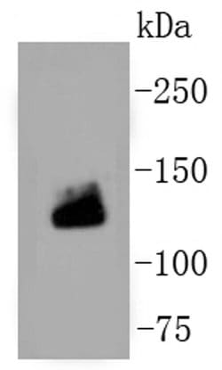 Collagen I Recombinant Rabbit Monoclonal Antibody (ST58-04), Invitrogen