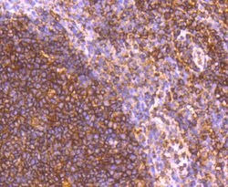 Invitrogen GRK2 Recombinant Rabbit Monoclonal Antibody (ST05-60) 100 &mu;L;