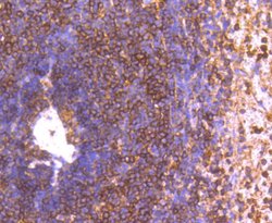 Invitrogen GRK2 Recombinant Rabbit Monoclonal Antibody (ST05-60) 100 &mu;L;
