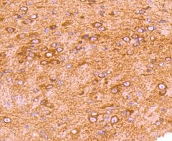 Invitrogen GRK2 Recombinant Rabbit Monoclonal Antibody (ST05-60) 100 &mu;L;