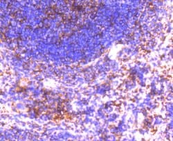 Invitrogen GRK2 Recombinant Rabbit Monoclonal Antibody (ST05-60) 100 &mu;L;