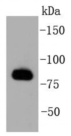 Invitrogen GRK2 Recombinant Rabbit Monoclonal Antibody (ST05-60) 100 &mu;L;