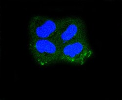 Cytokeratin 10 Recombinant Rabbit Monoclonal Antibody (ST05-43), Invitrogen&trade;