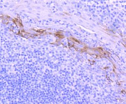 Cytokeratin 10 Recombinant Rabbit Monoclonal Antibody (ST05-43), Invitrogen&trade;